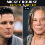 Mickey Rourke Before and After